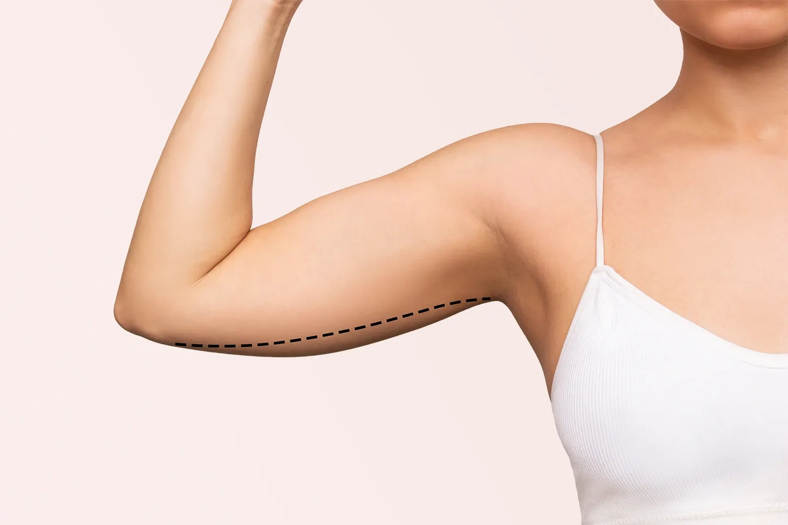 Arm lift showing smooth, contoured upper arms — Empowered Plastic Surgery, Sugar Land TX