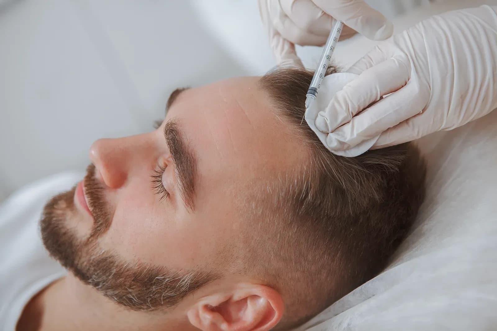 Hair PRP treatment showing improved hair density and scalp health — Empowered Plastic Surgery, Sugar Land TX